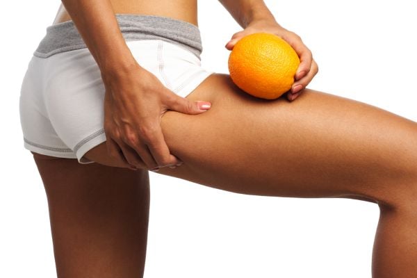 what causes cellulite