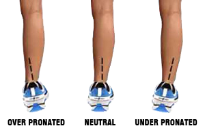 shin splints from walking