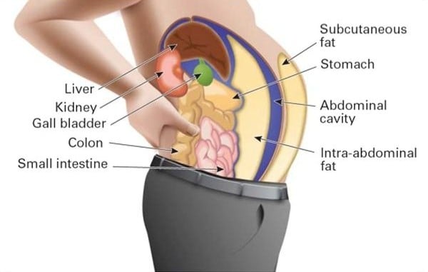 What Is Visceral Fat