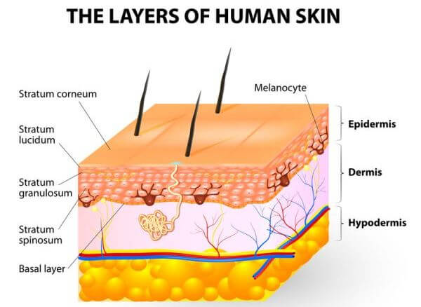 verminder striae