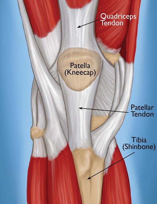 knee pain patella