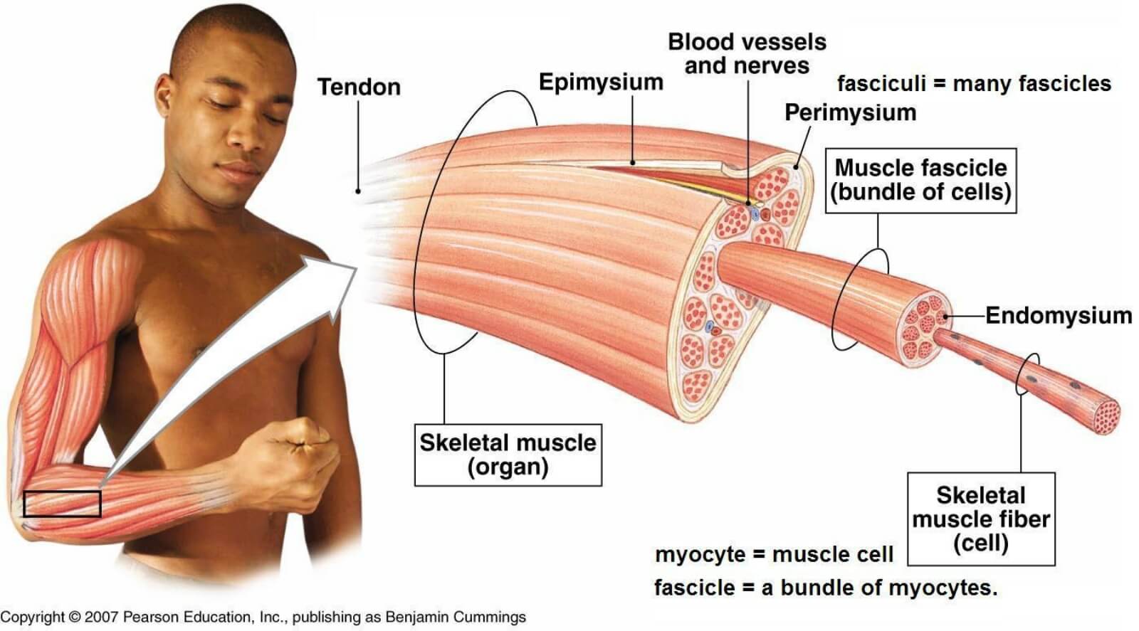 What Happens When Muscle Fibers Tear