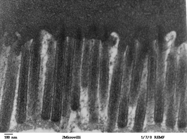 microvilli