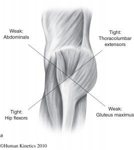 anterior-pelvic-tilt-muscle-imbalance