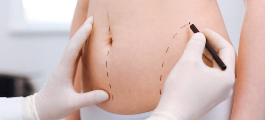 coolsculpting cost