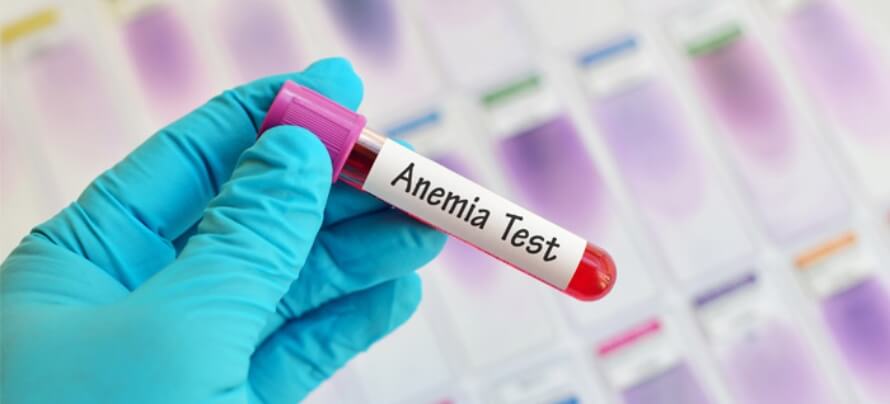 anemia-test (1)