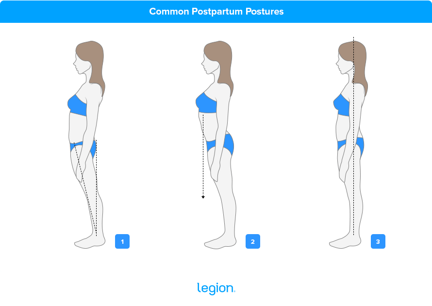 Common Postpartum Postures