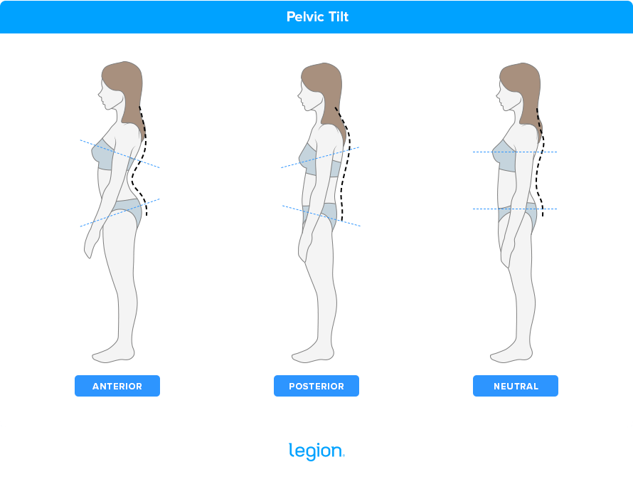 Anterior Pelvic Tilt: Fixes, Symptoms, and Exercises