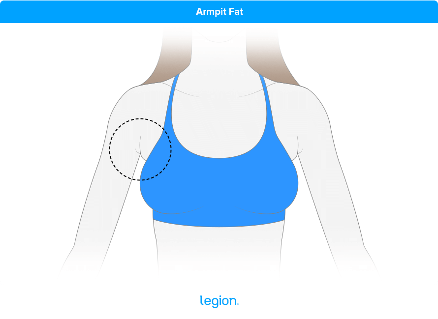 https://legionathletics.com/wp-content/uploads/2023/09/armpit-fat.png