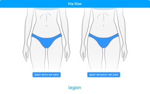 Hip Dips Explained: Causes, Workouts & Tips | Legion