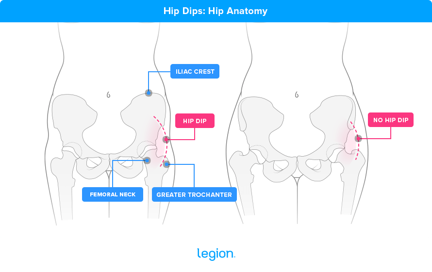 Hip Dips: Hip Anatomy