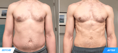 How Andrew Lost 30 Pounds & Dropped 10% Body Fat in 15 Months