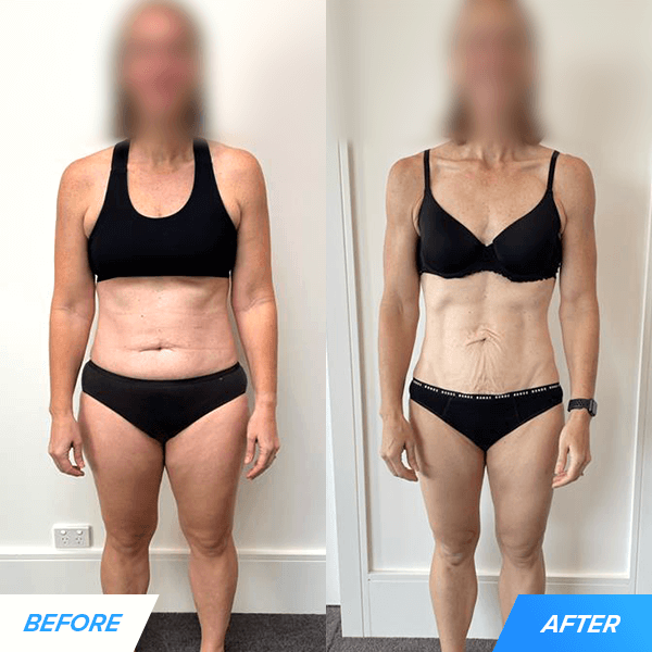 charlotte before and after
