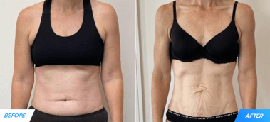 How Charlotte Lost 31 Pounds & Dropped 15% Body Fat in 6 Months