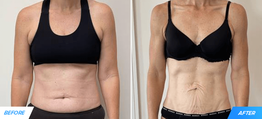 charlotte-legion-coaching-transformation featured