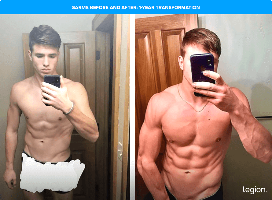 SARMs Before and After: 1-Year  Transformation