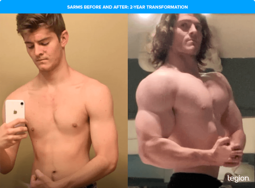 SARMs Before and After: 2-Year Transformation