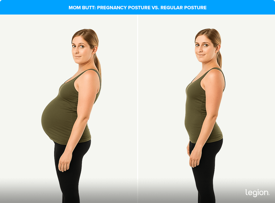 Mom Butt: Pregnancy Posture vs. Regular Posture