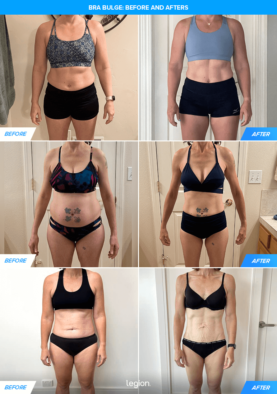 Bra Bulge: Before and Afters