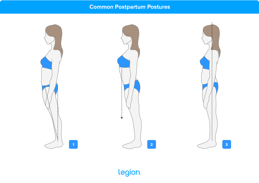 Postpartum posture fixes for diastasis recti: common postures that stress ab separation and a neutral stacked stance that supports healing.