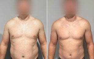How Connor Lost 20 Pounds & Dropped 10% Body Fat in 4 Months
