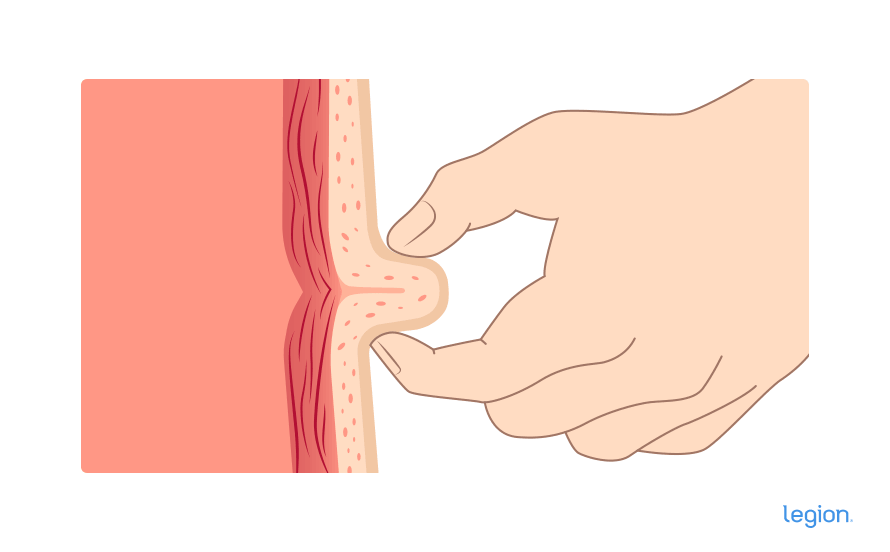 Caliper instructions step 2