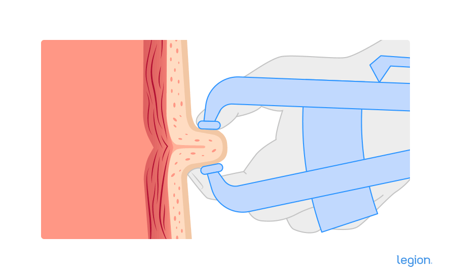 Caliper instructions step 4