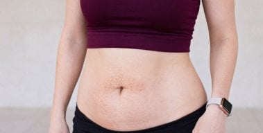 Mom Pooch: What Causes It and How to Get Rid of It