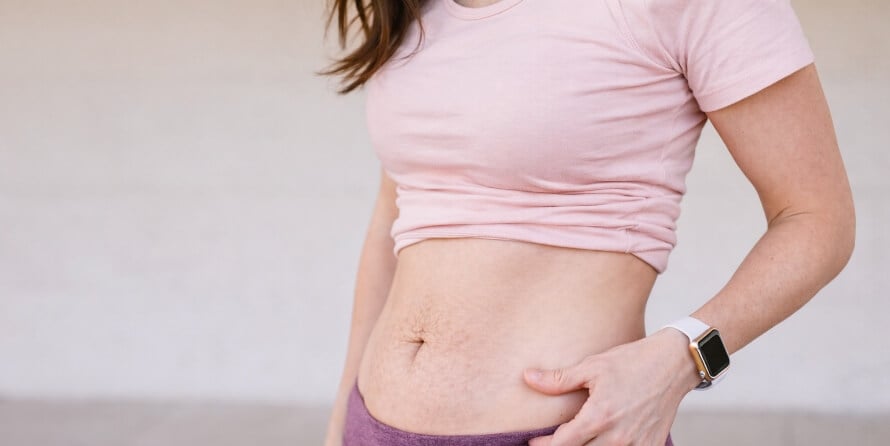 Post-pregnancy abdomen showing a mild mom pooch related to diastasis recti and natural lower belly fat distribution.