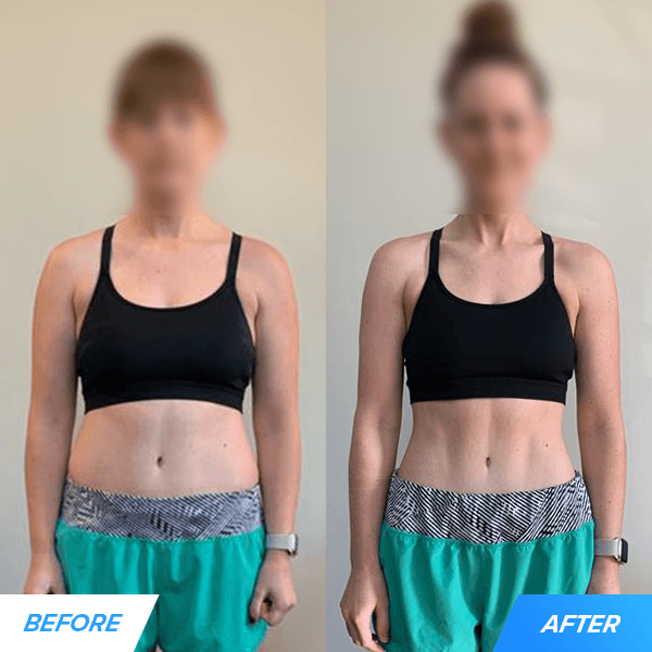 rebecca before and after 