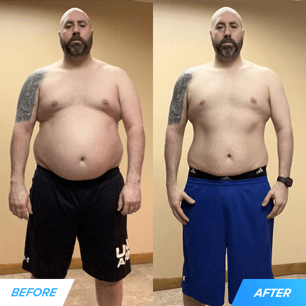 allan before and after