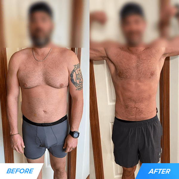 Harry before and after