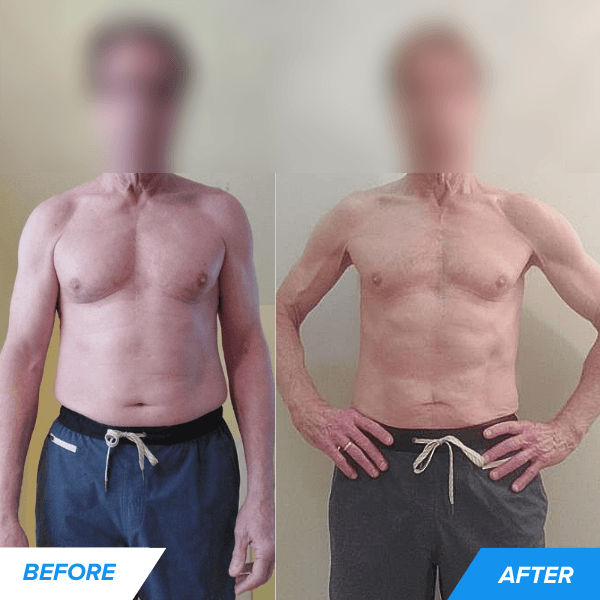 peter before and after