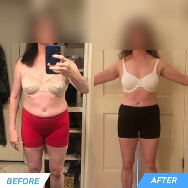 Brenda- Before & After